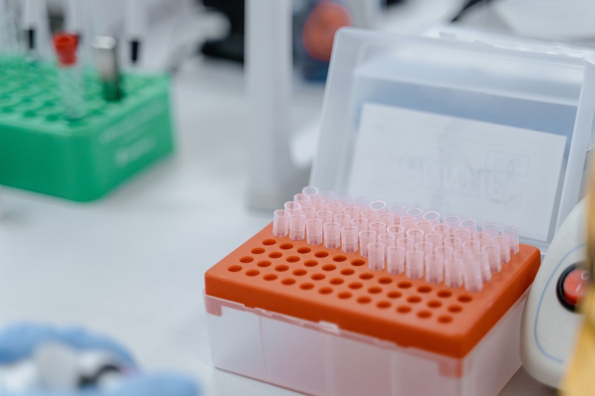 Laboratory pipette tips arranged in an orange rack