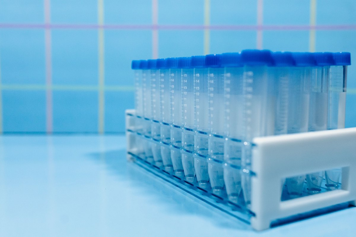 Blue-capped laboratory tubes standing in a white rack
